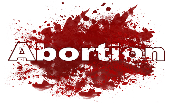 A box of aborted babies exposes more than late-term abortions